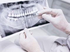 هل تضر السجائر الالكترونية بالأسنان