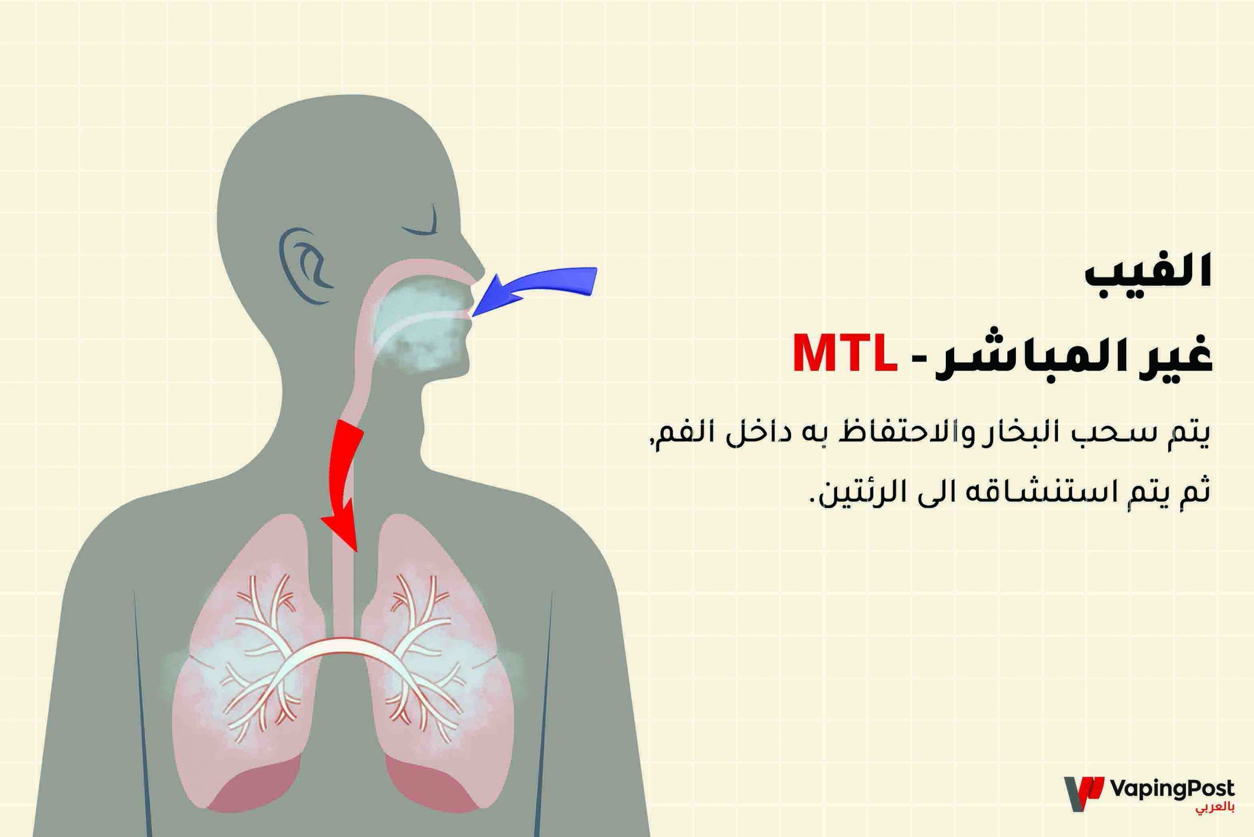 الفيب غير المباشر - MTL