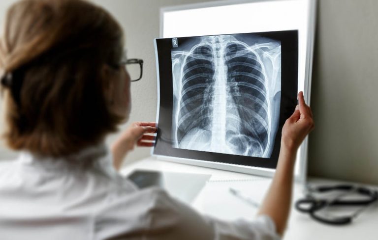 هل السجائر الالكترونية خطيرة على الرئتين؟