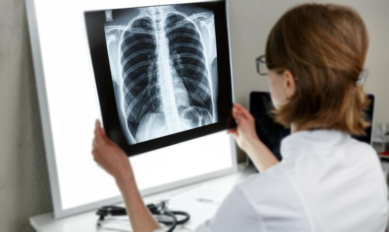 رئة الفشار و السجائر الالكترونية : ما بين الخرافة والحقيقة