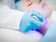 الليزر للإقلاع عن التدخين