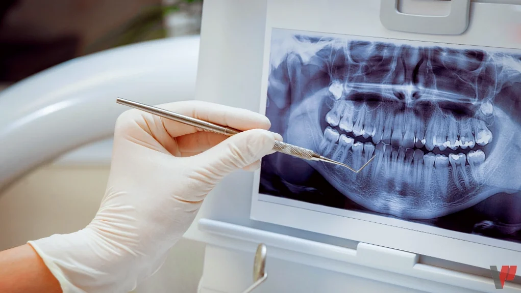 تأثير الفيب و السجائر التقليدية على صحة اللثة