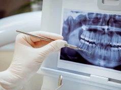 تأثير الفيب و السجائر التقليدية على صحة اللثة