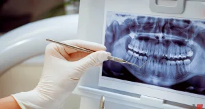 تأثير الفيب و السجائر التقليدية على صحة اللثة